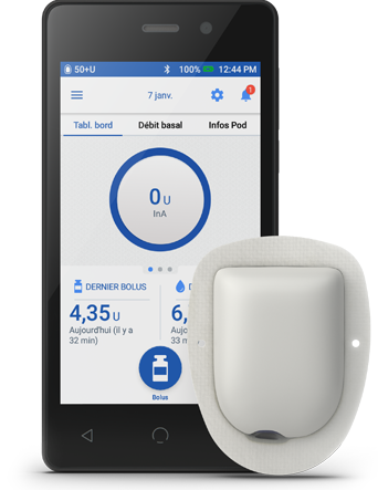 PDM and POD with adhesive