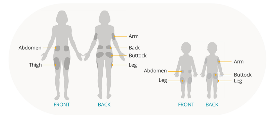 Omnipod Pod placement guide