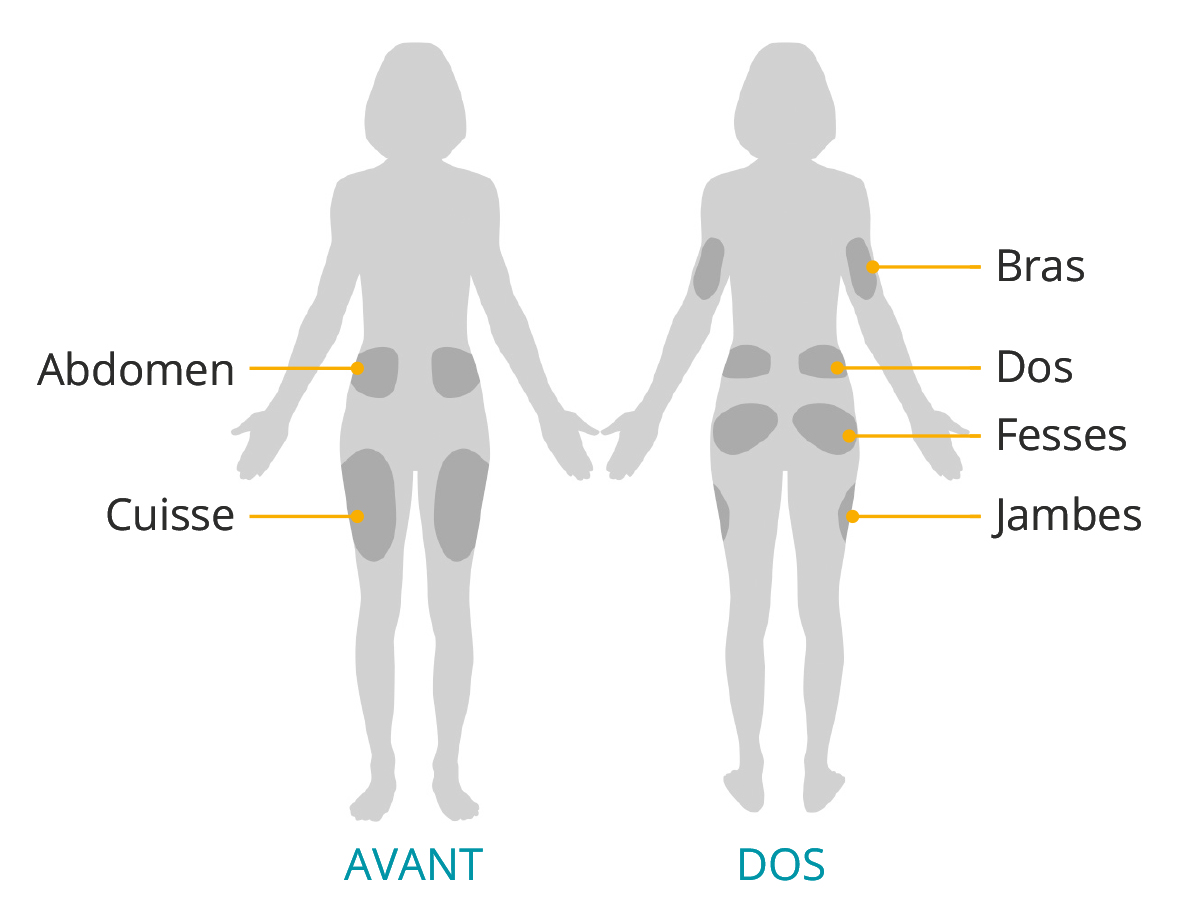 Adult - FR pod placement 