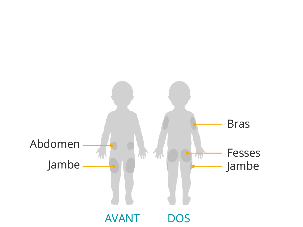 Child - FR pod placement 
