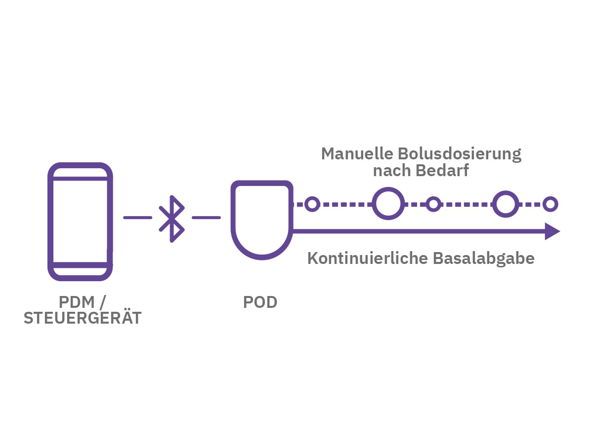 insulin pump graphic