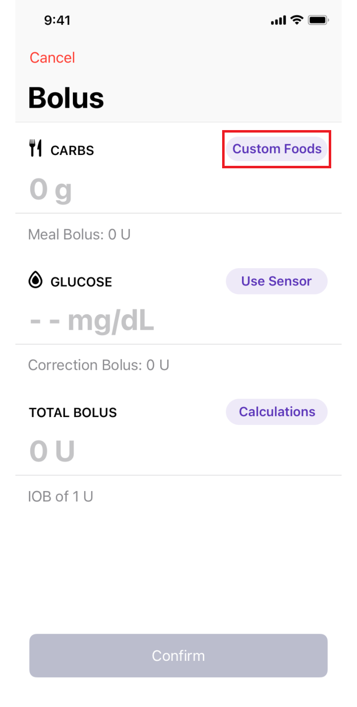 Custom Foods for iOS: tap the Custom Foods button