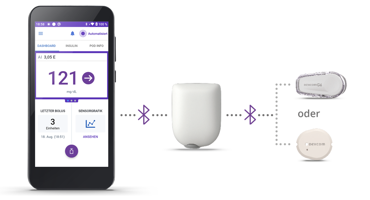 Omnipod 5 with Pod and Dexcom G6, G7 in a diagram in German