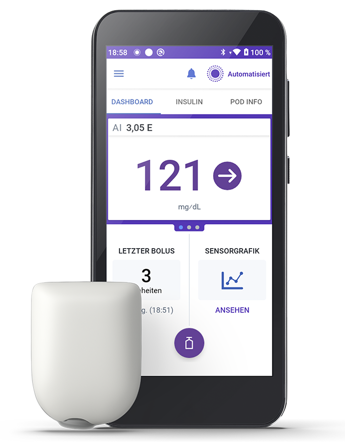 Omnipod 5 with Pod (no adhesive shown) on the left with measurements in mg/dL and text in German