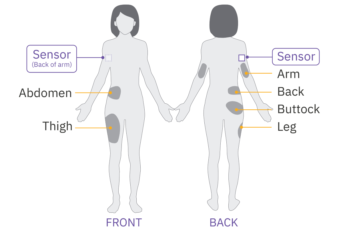 Pod Sensor placement with Dexcom G7 for an adult