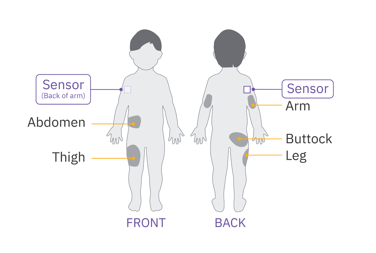 Pod Placement Sensor with Dexcom G7 for a child