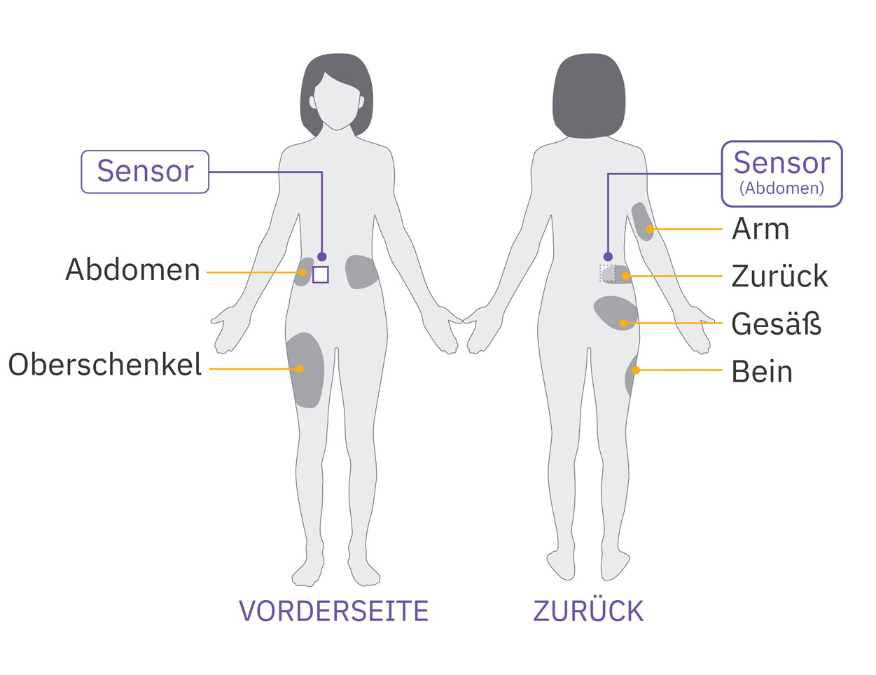 Pod sensor placement on abdomen of adult 