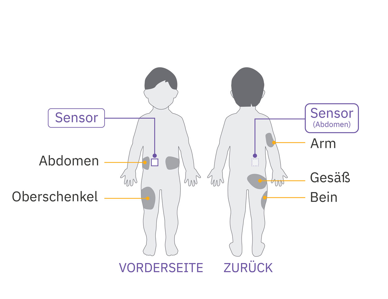 Pod sensor abdomen placement diagram on child