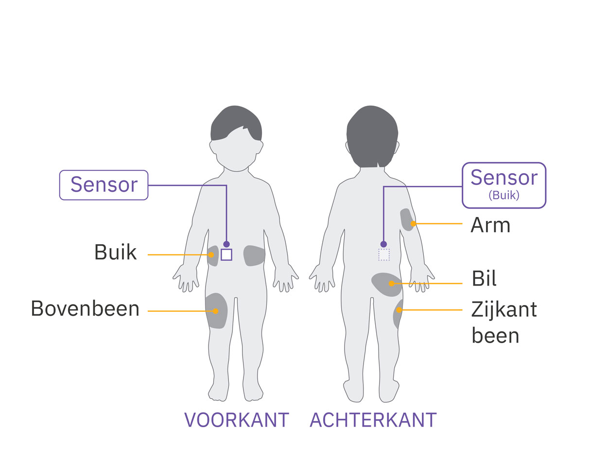 Pod sensor abdomen placement diagram on child