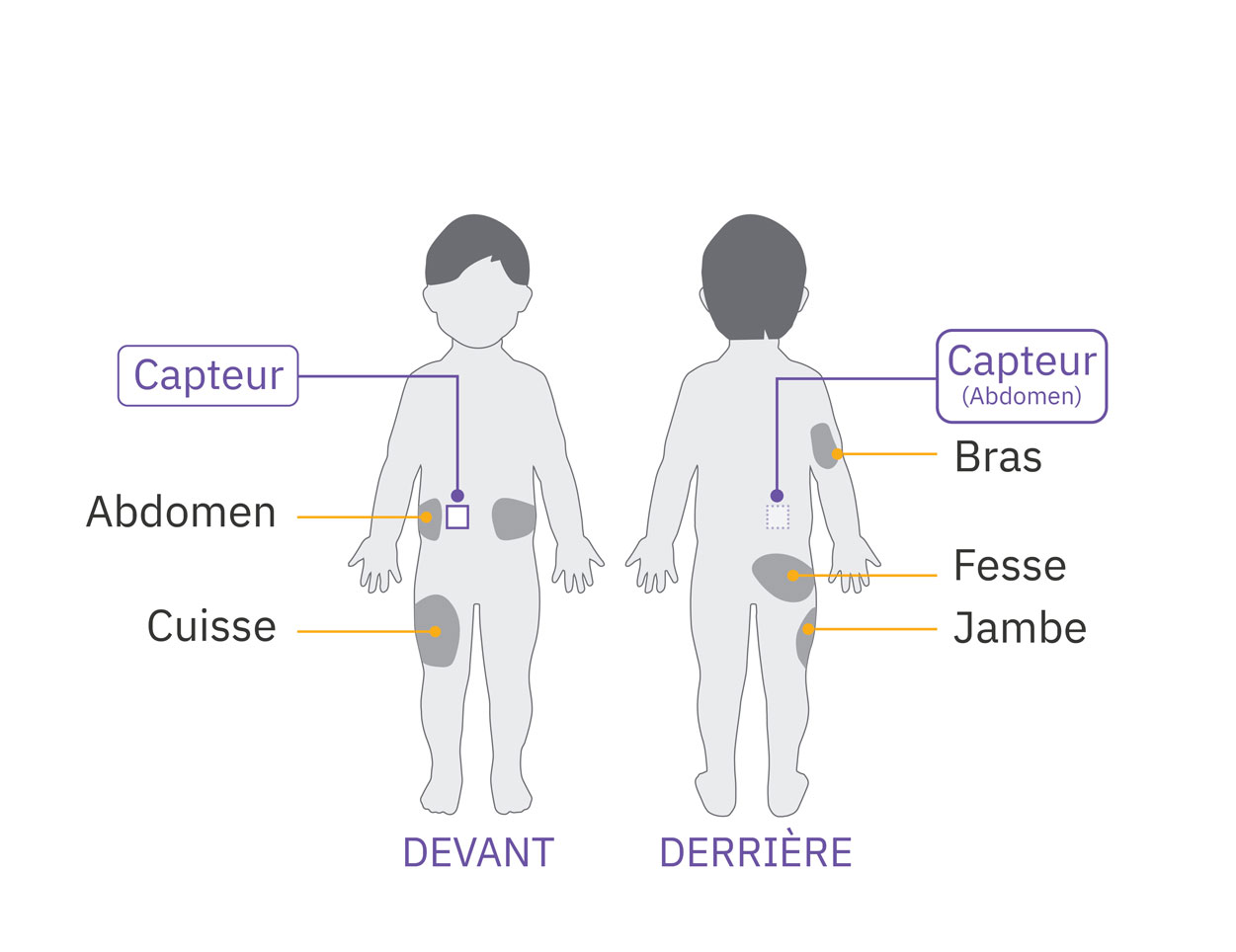 Pod sensor abdomen placement diagram on child