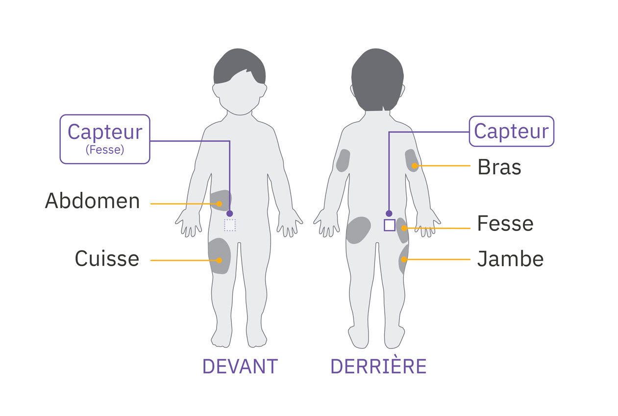 pod sensor buttock placement on child
