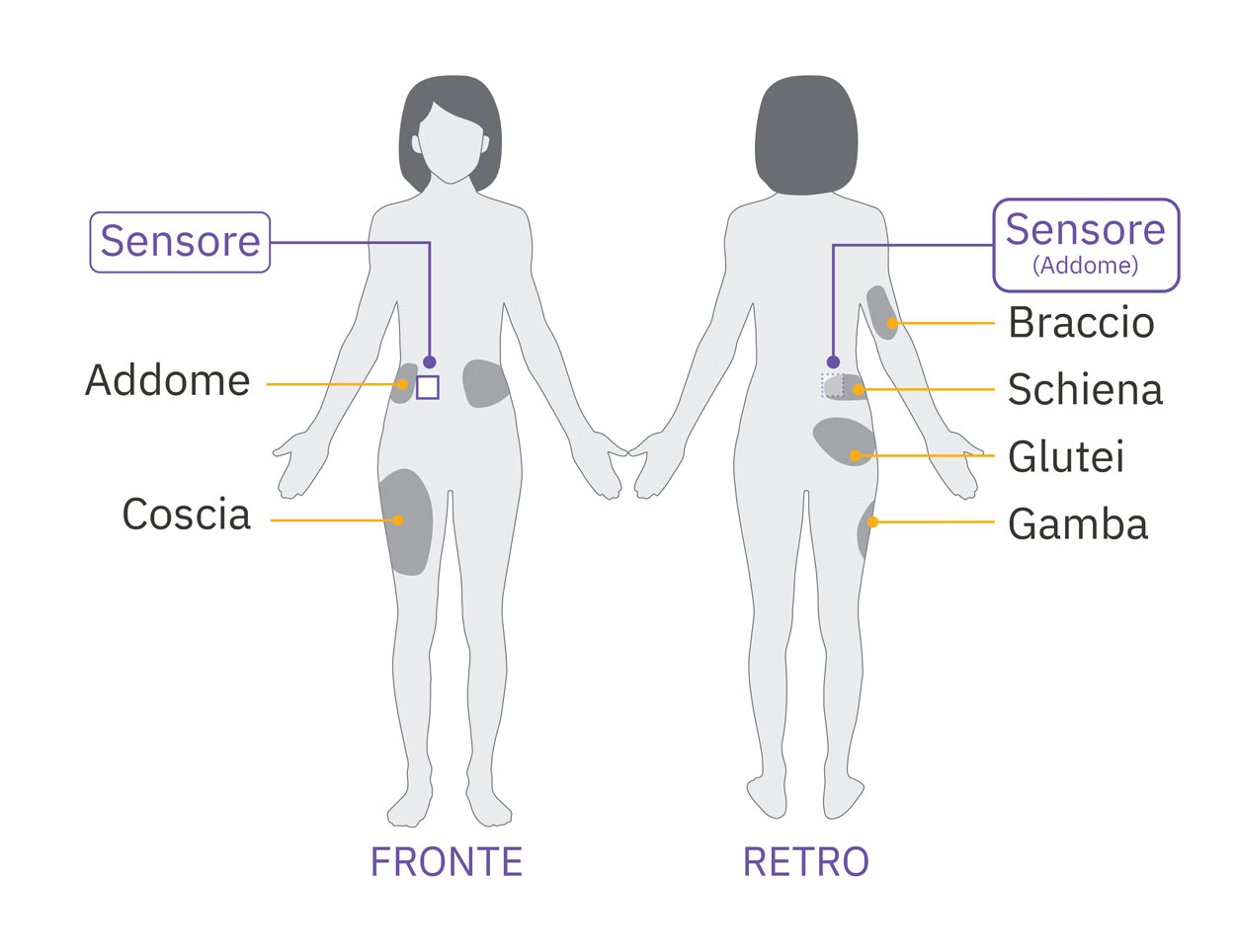 Pod sensor abdomen placement diagram on adult