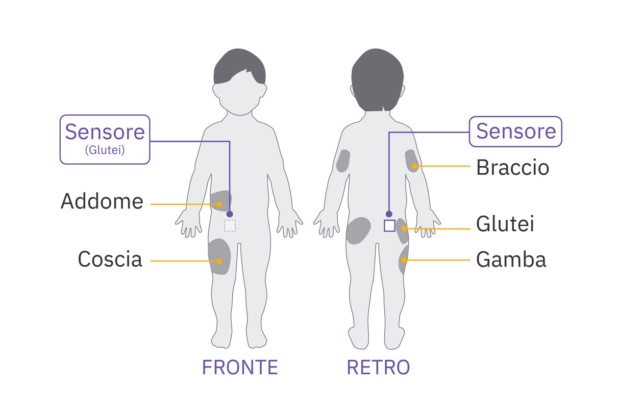 Pod sensor buttocks placement diagram on child