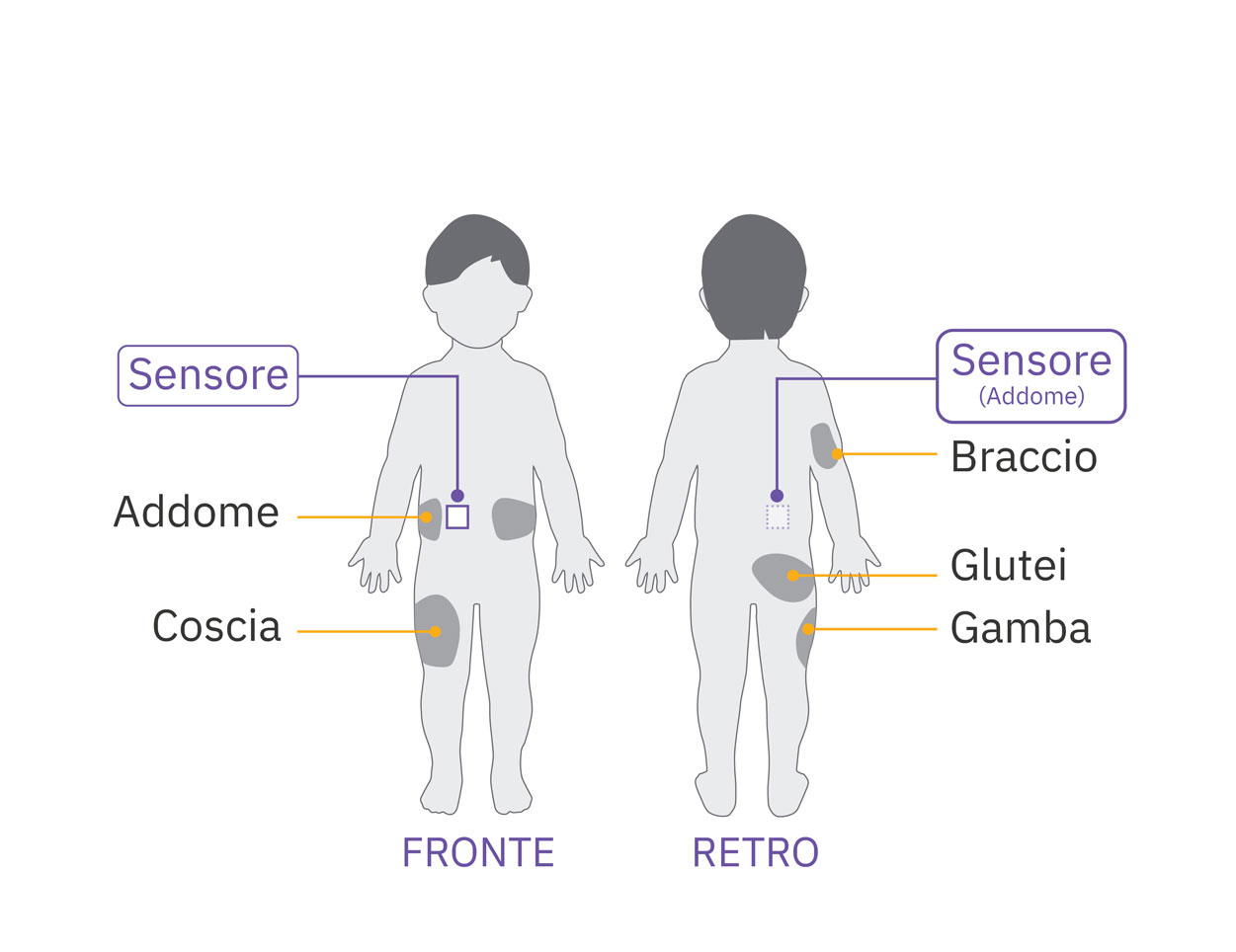 Pod sensor abdomen placement diagram on child