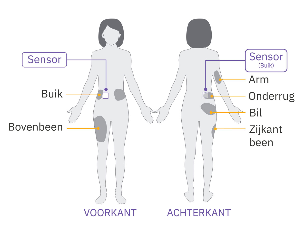 Pod sensor abdomen placement diagram on adult