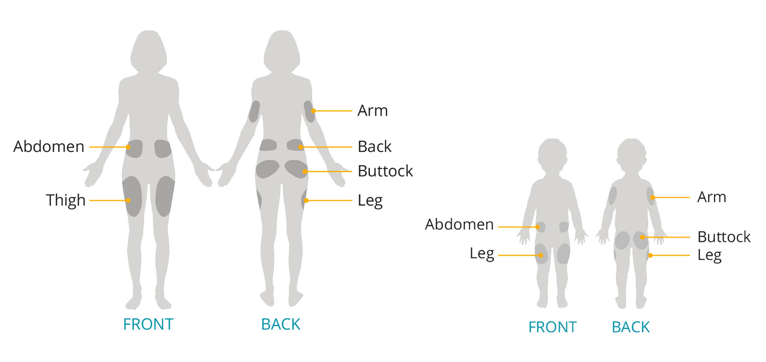 Pod sensor placement diagram on adult and child