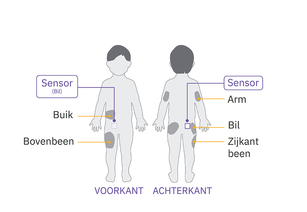 Pod sensor buttocks placement diagram on child