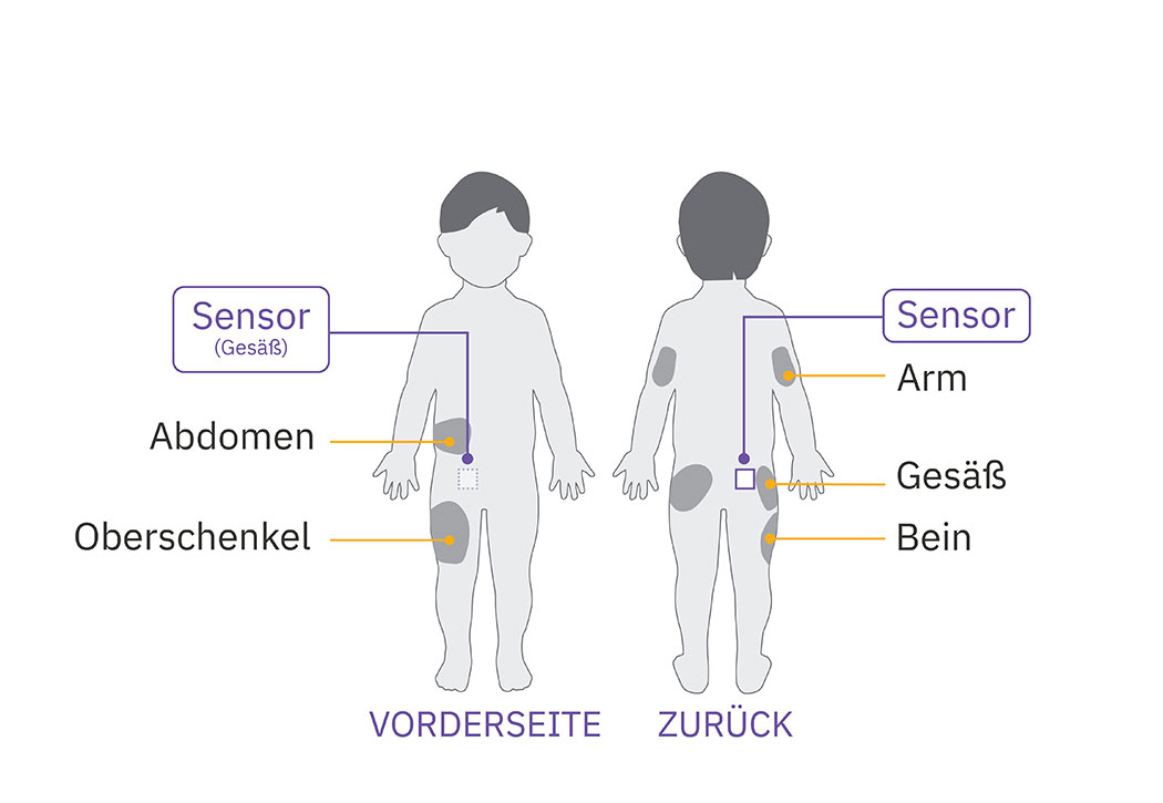 pod sensor buttock placement on child arm