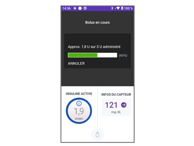 dashboard of auto delivering bolus