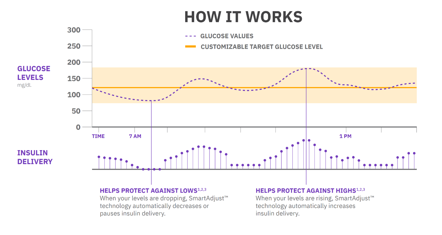 Automated Insulin Delivery Infographic