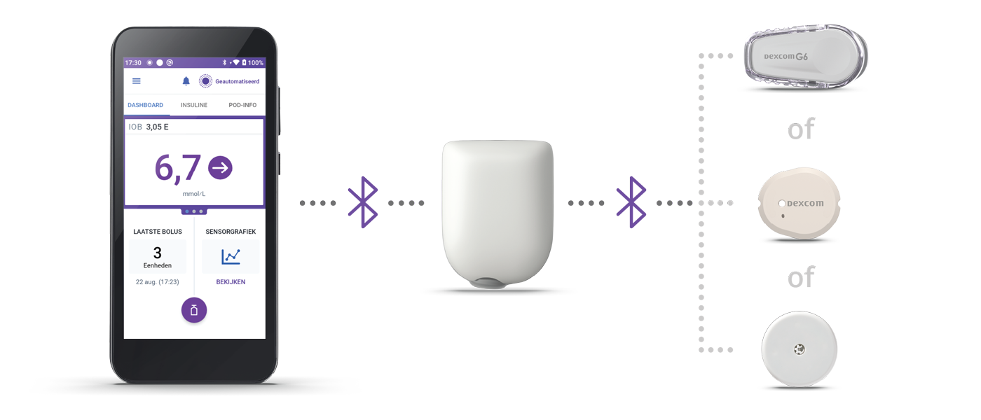 controller, pod, and three sensors