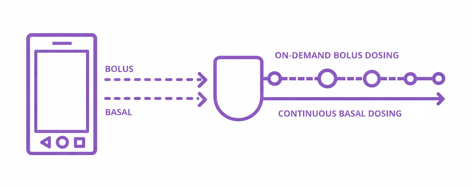 Diagram of tubeless continuous dosing