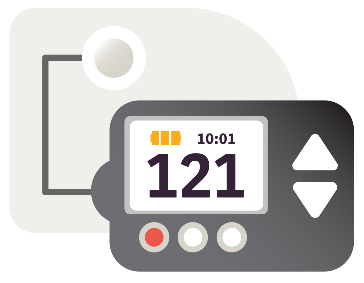 Terapia con bomba de insulina