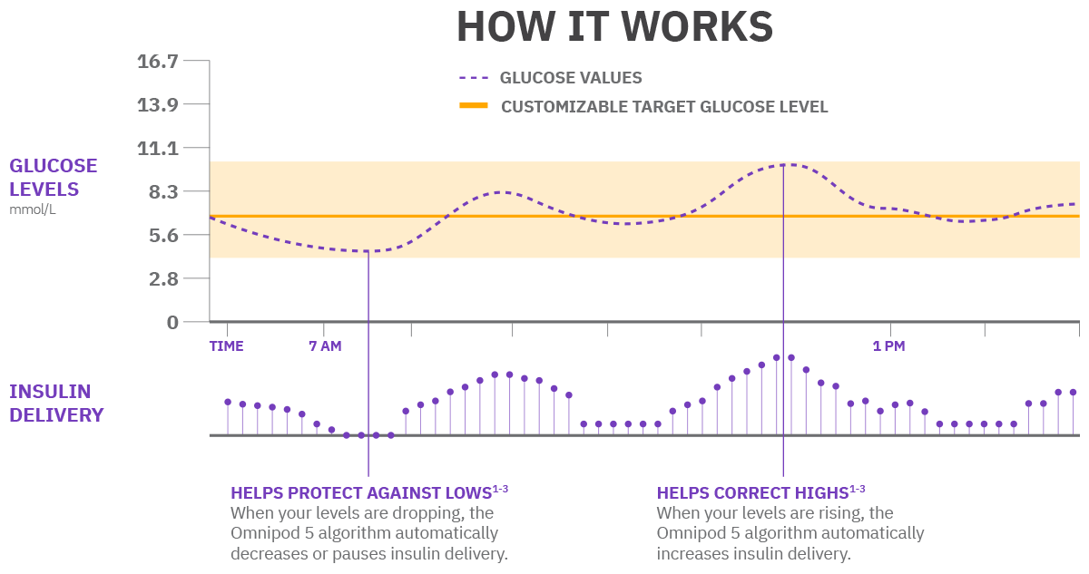How Automated Insulin Delivery works infographic