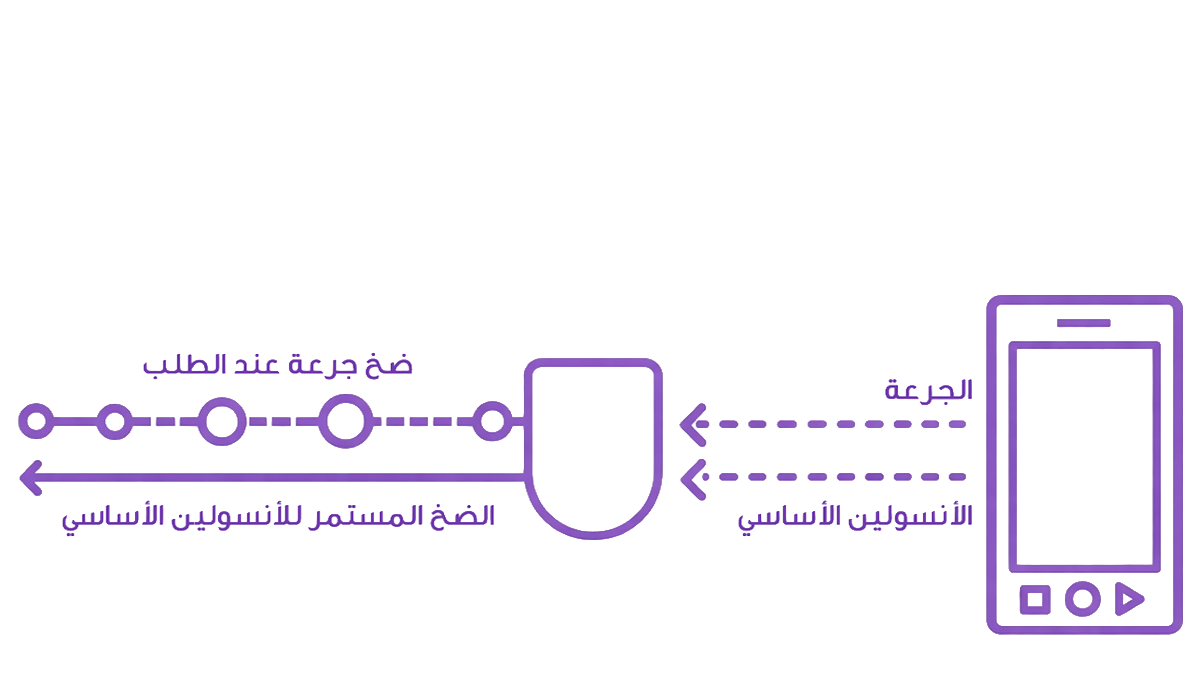 diagram of tubeless continuous dosing in Arabic