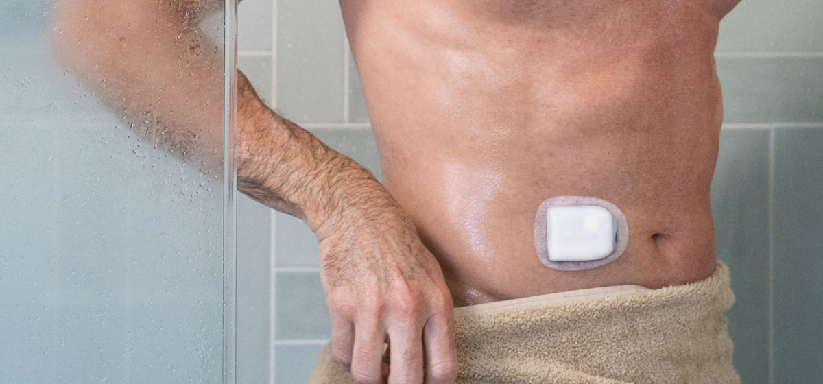 man with pod on his abdomen