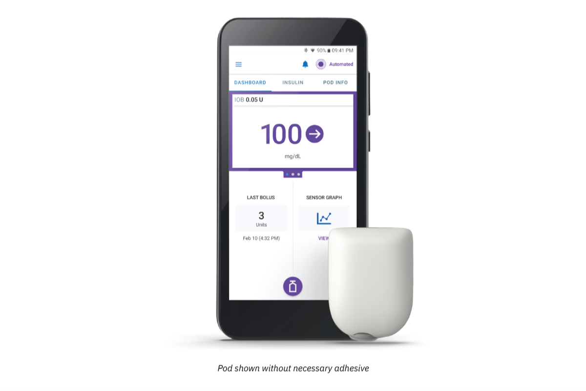 PDM and Pod without necessary adhesive