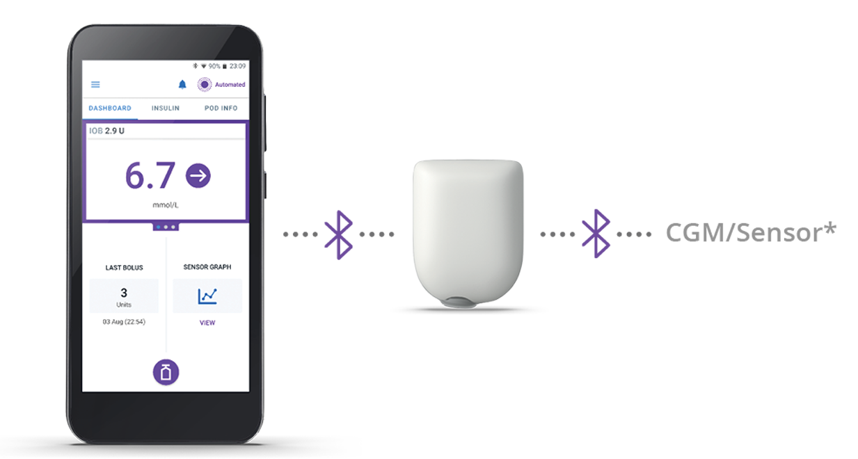 Three components of an automated insulin delivery system: displaying a glucose reading and trend graph, an insulin pump, and a sensor.