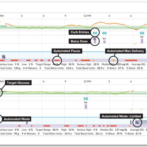 HCP Glooko Tips blog graph image